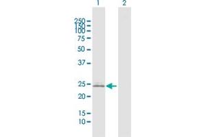 Western Blot analysis of IGKC expression in transfected 293T cell line by IGKC MaxPab polyclonal antibody. (IGKC 抗体  (AA 1-234))