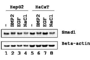 Image no. 1 for anti-SMAD, Mothers Against DPP Homolog 1 (SMAD1) (Ser206) antibody (ABIN401471) (SMAD1 抗体  (Ser206))