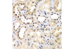 Immunohistochemistry of paraffin-embedded human kidney using ZNF264 antibody at dilution of 1:100 (x400 lens). (ZNF264 抗体)
