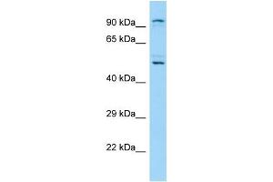Western Blotting (WB) image for anti-Lysine (K)-Specific Demethylase 1B (KDM1B) (N-Term) antibody (ABIN2790414) (KDM1B 抗体  (N-Term))