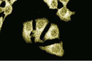 Immunofluorescent staining of HeLa cells with anti-Itch antibody. (ITCH 抗体  (AA 114-220))