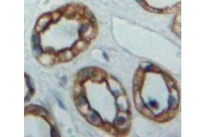 Used in DAB staining on fromalin fixed paraffin-embedded Kidney tissue (PTPRS 抗体  (AA 889-1102))