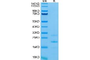 SDS-PAGE (SDS) image for Mannan-Binding Lectin serine Peptidase 2 (MASP2) (AA 287-685) protein (His tag) (ABIN7275293)