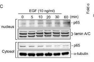 Nuclear factor (NF)-κB is involved in epidermal growth factor (EGF)-induced heme oxygenase (HO)-1 expression in HT-29 cells. (Lamin A/C 抗体)