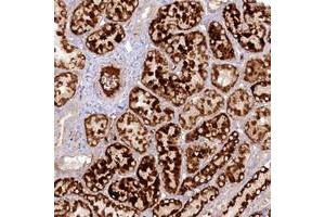Immunohistochemical staining of human kidney with PSAPL1 polyclonal antibody  shows strong cytoplasmic positivity in cells in tubules with distinct extracellular material at 1:50-1:200 dilution.