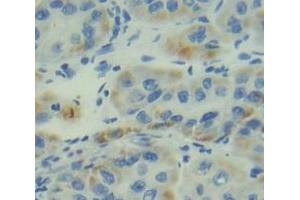 Figure. (ITGA5 抗体  (AA 895-1049))