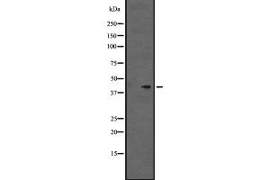 Western blot analysis of GPR86/GPR94 expression in Hela cell lysate,The lane on the left is treated with the antigen-specific peptide. (Purinergic Receptor P2Y, G-Protein Coupled, 13 (P2RY13) (C-Term) 抗体)