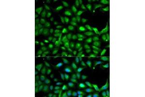 Immunofluorescence analysis of A-549 cells using IGF2 Polyclonal Antibody (IGF2 抗体)