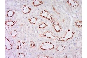 Paraformaldehyde-fixed, paraffin embedded rat kidney, Antigen retrieval by boiling in sodium citrate buffer (pH6) for 15min, Block endogenous peroxidase by 3% hydrogen peroxide for 30 minutes, Blocking buffer (normal goat serum) at 37°C for 20min, Antibody incubation with Rabbit Anti-Klotho Polyclonal Antibody, Unconjugated  at 1:200 overnight at 4°C, followed by a conjugated secondary and DAB staining. (Klotho 抗体  (AA 401-500))