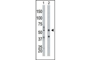 The anti-PRKR Pab (ABIN392778 and ABIN2837994) is used in Western blot to detect PRKR in mouse liver tissue lysate (Lane 1) and HepG2 cell lysate (Lane 2). (EIF2AK2 抗体  (N-Term))