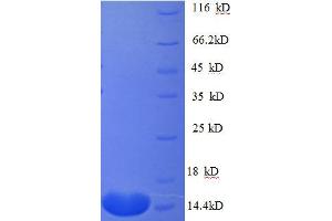 SDS-PAGE (SDS) image for Connective Tissue Growth Factor (CTGF) (AA 253-349), (partial) protein (His tag) (ABIN1095554)