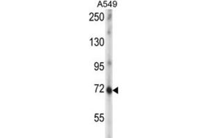 Western Blotting (WB) image for anti-Zinc Finger Protein 429 (ZNF429) antibody (ABIN5016641) (ZNF429 抗体)