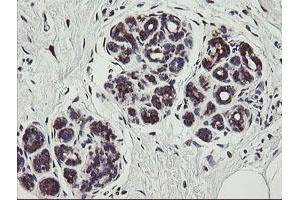 Immunohistochemical staining of paraffin-embedded Human breast tissue using anti-TPD52L3 mouse monoclonal antibody. (TPD52L3 抗体)