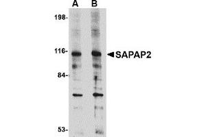 Western Blotting (WB) image for anti-Discs, Large (Drosophila) Homolog-Associated Protein 2 (DLGAP2) (Middle Region) antibody (ABIN1031077) (DLGAP2 抗体  (Middle Region))