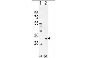 Western blot analysis of PRDX4 (arrow) using rabbit polyclonal PRDX4 Antibody (Center) (ABIN656035 and ABIN2845408). (Peroxiredoxin 4 抗体  (AA 82-110))