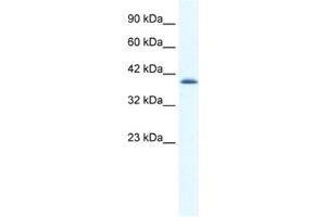 Western Blotting (WB) image for anti-Cation Channel, Sperm Associated 2 (CATSPER2) antibody (ABIN2461150) (CATSPER2 抗体)