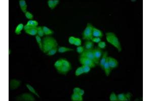 Immunofluorescence staining of PC-3 cells with ABIN7145758 at 1:100, counter-stained with DAPI. (BRAP 抗体  (AA 13-124))