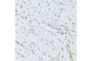 Immunohistochemistry of paraffin-embedded human endometrium using AIFM1 Antibody.