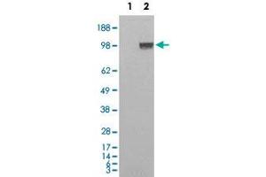 HEK293 overexpressing Human ENPP1 and probed with ENPP1 polyclonal antibody  (mock transfection in first lane) . (ENPP1 抗体  (C-Term))