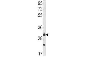 Western blot analysis of MyD88 antibody and mouse lung tissue lysate. (MYD88 抗体  (AA 136-164))