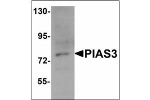 Western blot analysis of PIAS3 in K562 cell lysate with PIAS3 antibody at 1 µg/ml. (PIAS3 抗体  (C-Term))