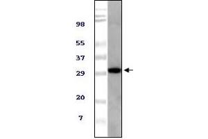 Western Blotting (WB) image for anti-Alveolar Soft Part Sarcoma Chromosome Region, Candidate 1 (ASPSCR1) (truncated) antibody (ABIN2464084) (ASPSCR1 抗体  (truncated))