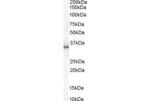 Western Blotting (WB) image for Uncoupling Protein 1 (Mitochondrial, Proton Carrier) (UCP1) peptide (ABIN369048) (Uncoupling Protein 1 (Mitochondrial, Proton Carrier) (UCP1) Peptide)