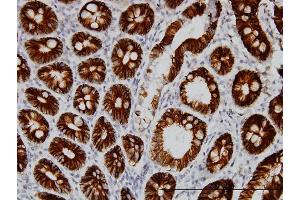 Immunoperoxidase of monoclonal antibody to CDH17 on formalin-fixed paraffin-embedded human small Intestine. (LI Cadherin 抗体  (AA 24-131))