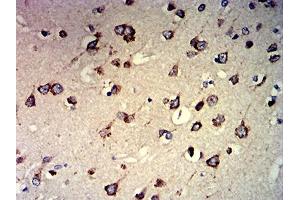 Immunohistochemical analysis of paraffin-embedded brain tissues using CCND1 mouse mAb with DAB staining.