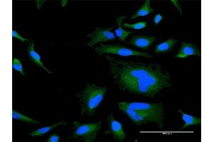 Immunofluorescence of purified MaxPab antibody to RGS21 on HeLa cell. (RGS21 抗体  (AA 1-152))