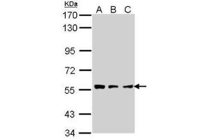 WB Image Sample (30 ug of whole cell lysate) A: A431 , B: H1299 C: Hela 7. (TPP1 抗体)