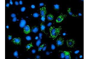 Anti-AK4 mouse monoclonal antibody (ABIN2454798) immunofluorescent staining of COS7 cells transiently transfected by pCMV6-ENTRY AK4 (RC220572). (AK4 抗体)