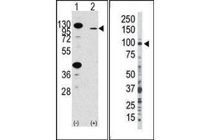 (LEFT) Western blot analysis of anti-hFGFR2-R22 Pab in 293 cell line lysates transiently transfected with the FGFR2 gene (2ug/lane). (FGFR2 抗体  (N-Term))