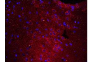 Immunofluorescence (Paraffin-embedded Sections) (IF (p)) image for anti-Protein tyrosine Phosphatase, Receptor Type, A (PTPRA) (AA 151-250) antibody (ABIN754633)