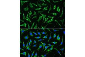Immunofluorescence analysis of L929 cells using PAI-1/Serpin E1 antibody (ABIN6131330, ABIN6147601, ABIN6147603 and ABIN6221802) at dilution of 1:100. (PAI1 抗体  (AA 24-402))