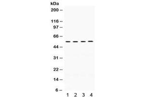 Western blot testing of human 1) A549, 2) HeLa, 3) MCF7, 4) SW620 cell lysate with FMO2 antibody.