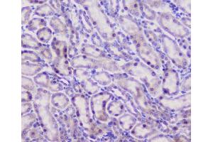 IHC analysis of CFP using anti-CFP antibody (ABIN6719298).