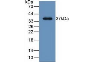 Detection of Recombinant LRG1, Human using Monoclonal Antibody to Leucine Rich Alpha-2-Glycoprotein 1 (LRG1) (LRG1 抗体  (AA 37-340))