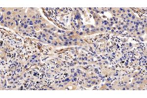 Immunohistochemistry (IHC) image for anti-Calponin 1 (CNN1) (AA 1-268) antibody (ABIN7436681)