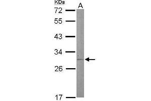Western Blotting (WB) image for anti-Steroidogenic Acute Regulatory Protein (STAR) antibody (ABIN2856168)