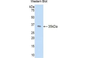 Western blot analysis of the recombinant protein. (LEFTY1 抗体  (AA 78-361))