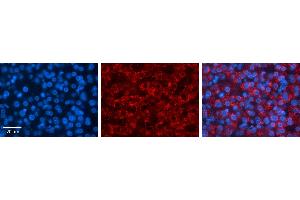 Immunohistochemistry (IHC) image for anti-3'-phosphoadenosine 5'-phosphosulfate Synthase 2 (PAPSS2) (C-Term) antibody (ABIN2783448)