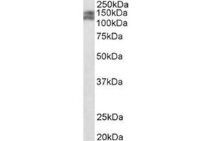 AP31771PU-N PARD3B antibody staining of Mouse fetal Kidney lysate at 0. (PARD3B 抗体  (C-Term))