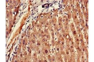 Immunohistochemistry of paraffin-embedded human liver tissue using ABIN7152606 at dilution of 1:100 (FADS1 抗体  (AA 1-121))