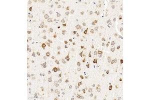 Immunohistochemistry of paraffin embedded mouse brain using CHST6 (ABIN7073302) at dilution of 1:2000 (300x lens) (CHST6 抗体)