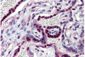 Human Placenta (formalin-fixed, paraffin-embedded) stained with NR2E1 antibody ABIN462191 followed by biotinylated goat anti-rabbit IgG secondary antibody ABIN481713, alkaline phosphatase-streptavidin and chromogen.