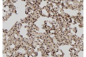 ABIN6273020 at 1/100 staining Rat lung tissue by IHC-P. (TIA1 抗体  (Internal Region))