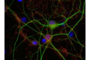 Indirect immunostaining of PFA fixed rat hippocampus neurons with anti-synaptogyrin 1 (dilution 1 : 500; red) and mouse anti-MAP 2 (, dilution 1 : 500; green). (Synaptogyrin 1 抗体  (AA 220-234))