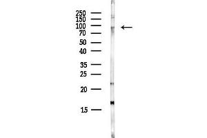 Western blot analysis of lysates from COLO205 cells(heat-shock,45 min treatment), using DGKG Antibody at 1/1000 dilution.