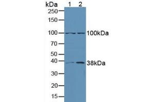 Western blot analysis of (1) Human A549 Cells and (2) Human Lung Tissue. (ERK1 抗体  (AA 75-312))
